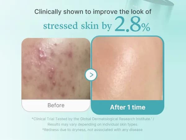 medicube Azelaic Acid Niacinamide Clear Toner Очищающий тоник с 4% азелаиновой кислоты 250 мл — миниатюра 4