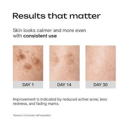medicube Azelaic Acid Niacinamide Clear Toner Очищающий тоник с 4% азелаиновой кислоты 250 мл — миниатюра 5